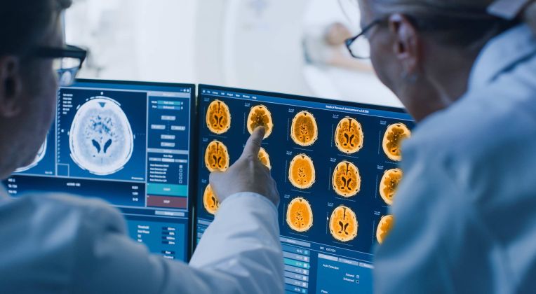 Zwei Mediziner sehen sich Scanbilder eines Gehirns von einem Computertomographen auf einem Bildschirm an